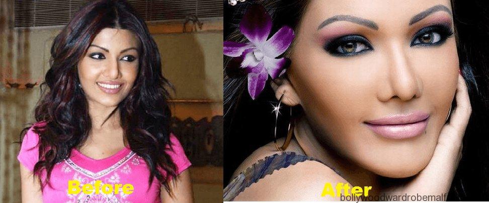 Koena Mitra Plastic Surgery - Page 10 of 10